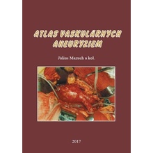 Atlas vaskulárnych aneuryziem - Július Mazuch a kolektív