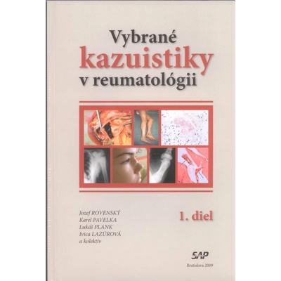 Vybrané kazuistiky v reumatológii 1+2 diel - Jozef Rovenský, Karel Pavelka, Lukáš Plank, Ivica Lazúrová