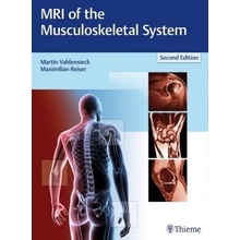 MRI of the Musculoskeletal System - Vahlensieck, Martin