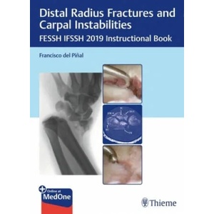 Distal Radius Fractures and Carpal Instabilities | Francisco Del Pinal (2019)