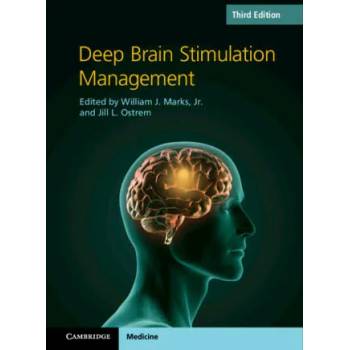 Image 1 of Deep Brain Stimulation Management | WILLIAM J. MARKS