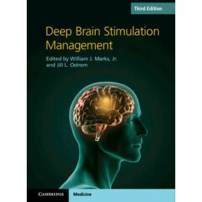 Deep Brain Stimulation Management | WILLIAM J. MARKS
