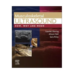 Musculoskeletal Ultrasound (ISBN: 9780702081989)