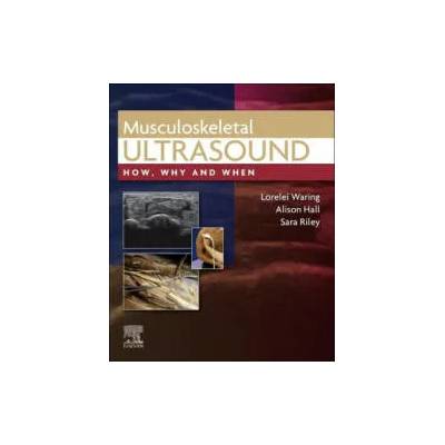 Musculoskeletal Ultrasound | LORELEI WARING