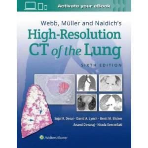 Webb, Muller and Naidich's High-Resolution CT of the Lung (ISBN: 9781975144432)