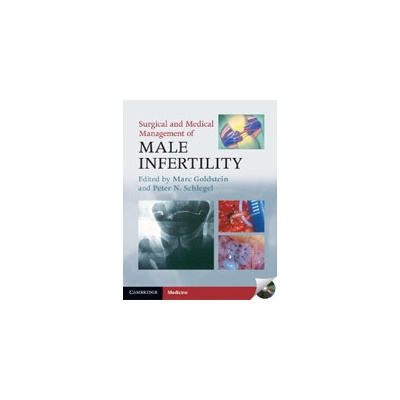Surgical and Medical Management of Male Infertilit - Goldstein, M., Schlegel, P. N.