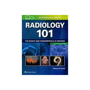 Radiology 101 | Smith (ISBN: 9781496392985)