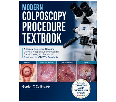 Modern Colposcopy Procedure Textbook