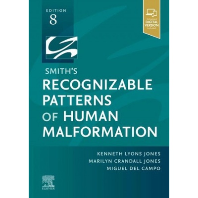 Smith's Recognizable Patterns of Human Malformation
