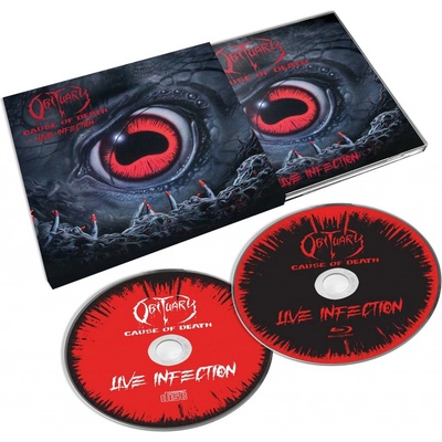 Obituary - Cause Of Death Live Infection CD