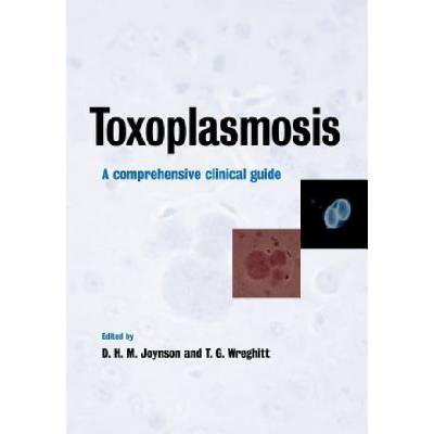Toxoplasmosis | David H. M. JoynsonTim G. Wreghitt