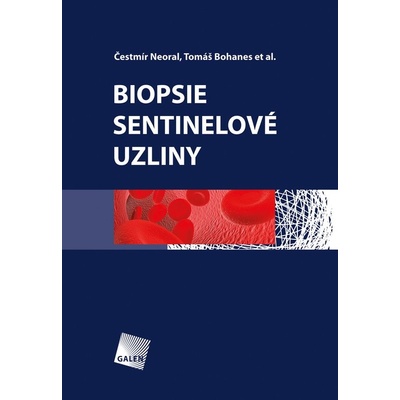 Biopsie sentinelové uzliny