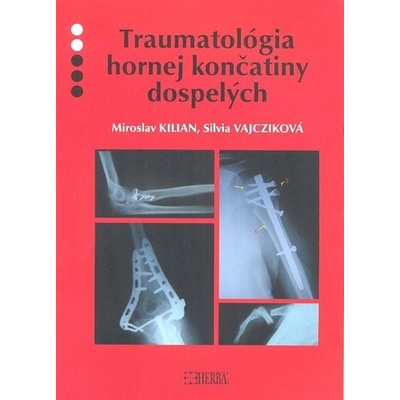 Traumatológia hornej končatiny dospelých - Kilian Miroslav