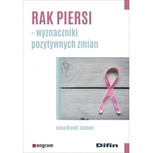 Rak piersi