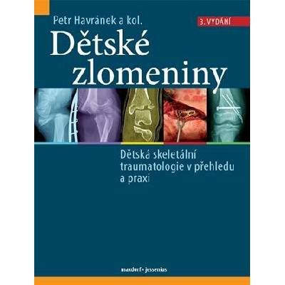 Dětské zlomeniny - Dětská skeletální traumatologie v přehledu a praxi