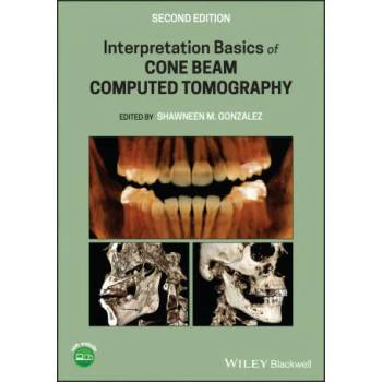 Image 1 of Interpretation Basics of Cone Beam Computed Tomography | SM Gonzalez