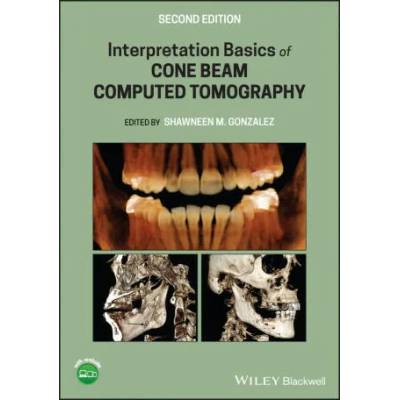 Interpretation Basics of Cone Beam Computed Tomography | SM Gonzalez