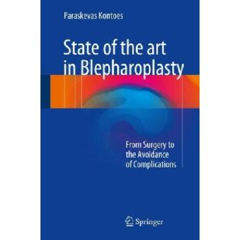 Image 1 of State of the art in Blepharoplasty | Paraskevas Kontoes