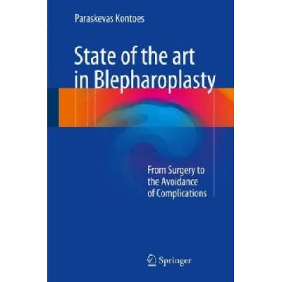 State of the art in Blepharoplasty | Paraskevas Kontoes