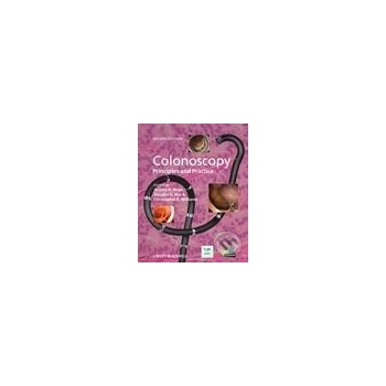 Colonoscopy: Principles and Practice