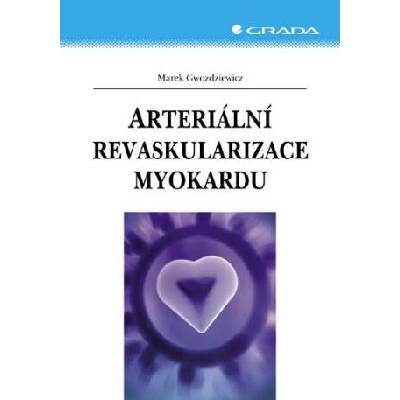 Arteriální revaskularizace myokardu - Marek Gwozdziewicz - e-kniha