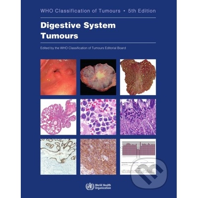 Who Classification of Tumours: Digestive System Tumours -
