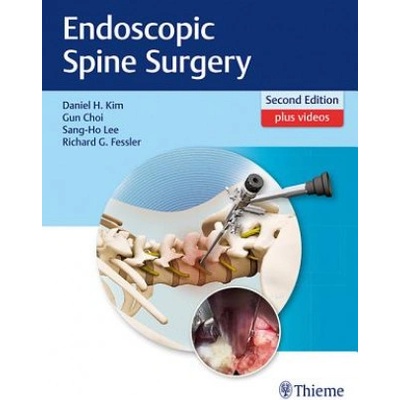 Endoscopic Spine SurgeryPevná vazba