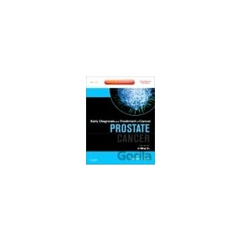 Prostate Cancer - Li-Ming Su