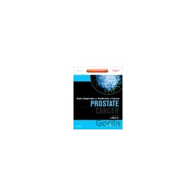 Prostate Cancer - Li-Ming Su