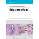 Endometrióza