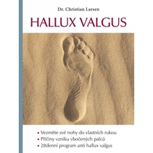 Hallux valgus - Larsen Christian