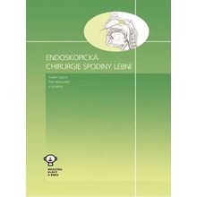 Endoskopická chirurgie spodiny lební Radim Lipna:Petr Matoušek a kolektiv autorů