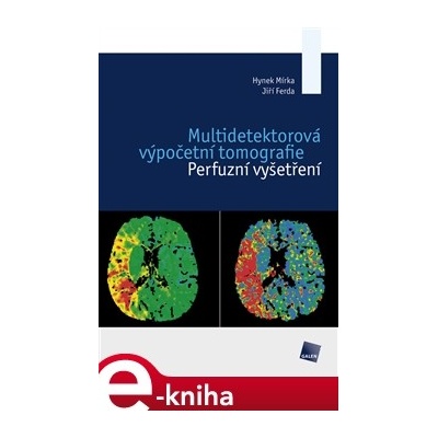 Multidetektorová výpočetní tomografie. Perfuzní vyšetření - Hynek Mírka, Jiří Ferda