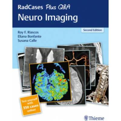 RadCases Plus Q&A Neuro Imaging | Roy Riascos, Eliana Bonfante, Susana Calle