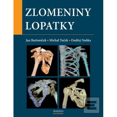 Zlomeniny lopatky