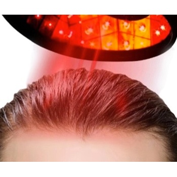Yalong Trade Laserová helma na podporu růstu vlasů