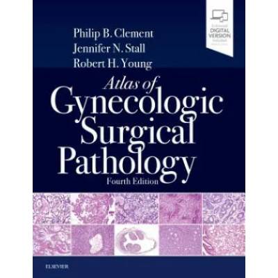 Atlas of Gynecologic Surgical Pathology | Philip B. Clement, Jennifer Stall, Robert H. Young