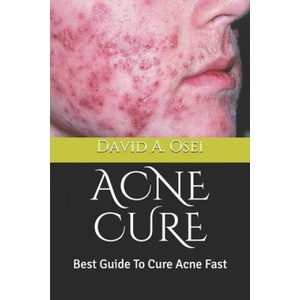 Acne Cure: Best Guide To Cure Acne Fast | David a. Osei (ISBN: 9781709964107)