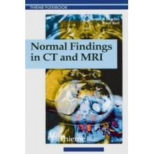 Normal Findings in CT and MRI