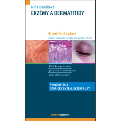 Ekzémy a dermatitidy | Nina Benáková