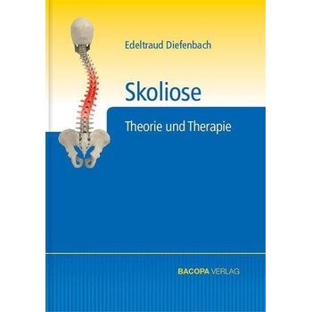Skoliose