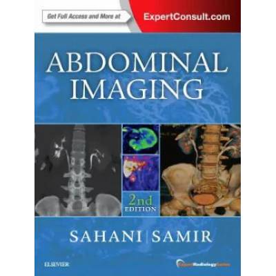 Abdominal Imaging | Sahani, Dushyant V. , M. D. , Anthony E. Samir