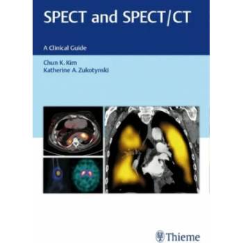 Image 1 of SPECT and SPECT/CT | Chun Kim, Katherine Zukotynski