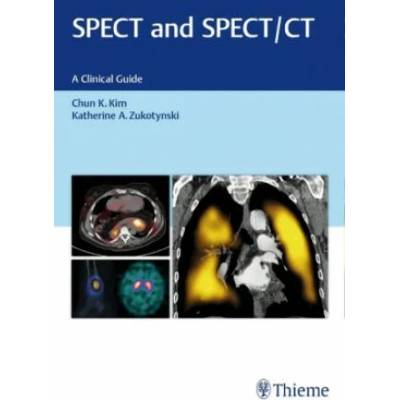 SPECT and SPECT/CT | Chun Kim, Katherine Zukotynski