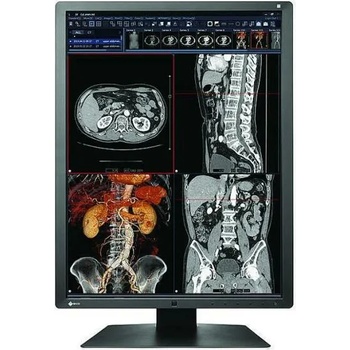 Image 1 of EIZO RadiForce RX250
