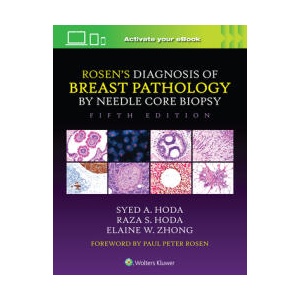 Rosen's Diagnosis of Breast Pathology by Needle Core Biopsy | Syed A. Hoda, Raza S. Hoda, Elaine Zhong (ISBN: 9781975198367)