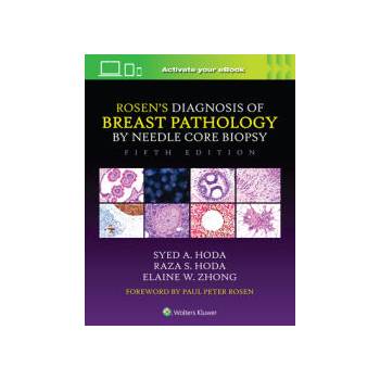Image 1 of Rosen's Diagnosis of Breast Pathology by Needle Core Biopsy | Syed A. Hoda, Raza S. Hoda, Elaine Zhong