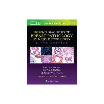 Rosen's Diagnosis of Breast Pathology by Needle Core Biopsy | Syed A. Hoda, Raza S. Hoda, Elaine Zhong