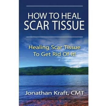 How to Heal Scar Tissue: How to Heal Your Own Scar Tissue And Get Rid Of It!