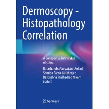 Dermoscopy - Histopathology Correlation | Balachandra Suryakant Ankad, Samipa Samir Mukherjee, Balkrishna Pralhadrao Nikam